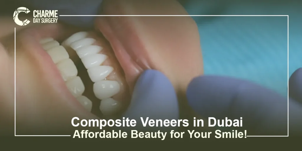 Composite Veneers in Dubai