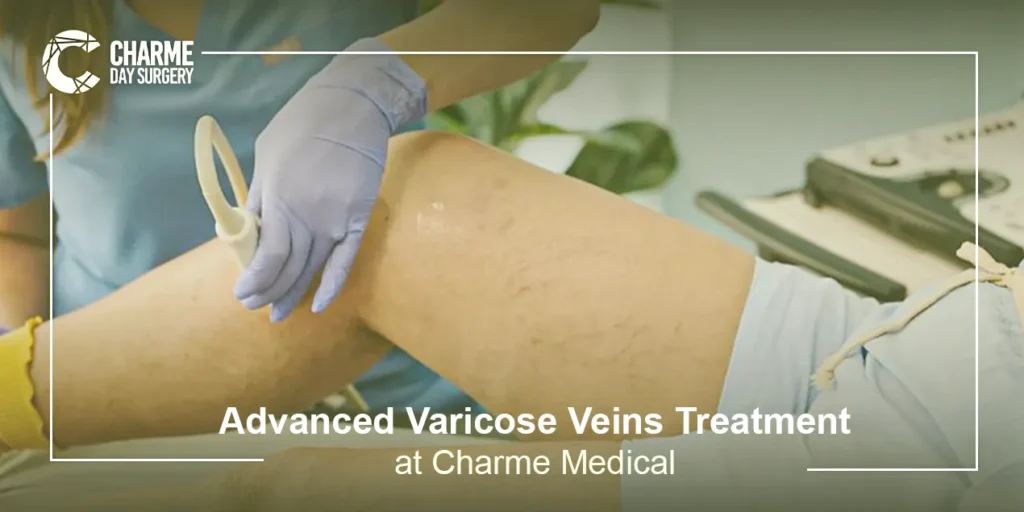 Varicose Veins Treatment