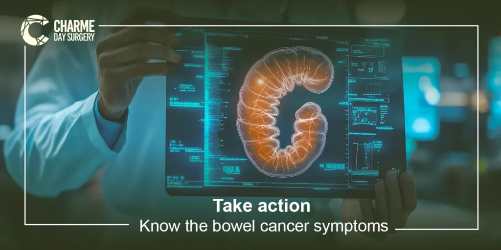 bowel cancer symptoms